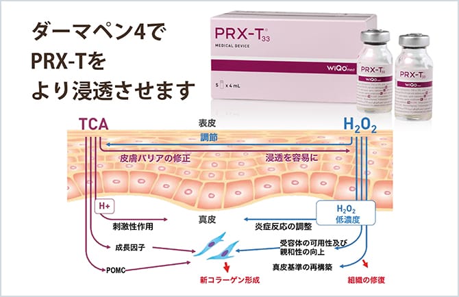 ダーマペン4でPRX-Tをより浸透させる