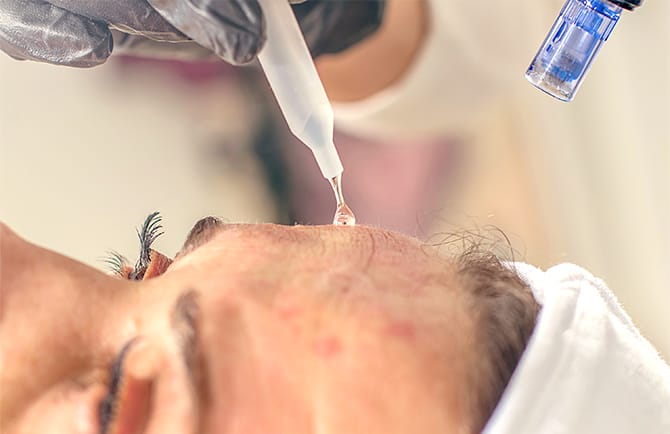 マッサージピールの施術の流れ