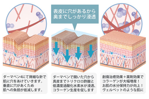 ヴェルベットスキンの治療