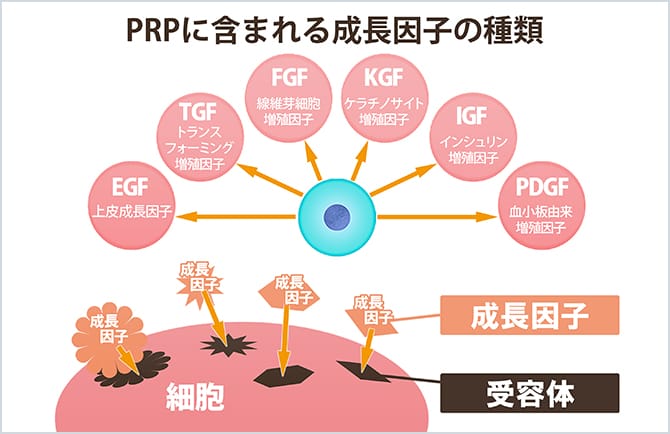 PRPに含まれる成長因子の種類