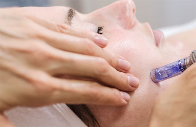 ACRS療法(自己血サイトカインリッチ血清)の施術の流れ