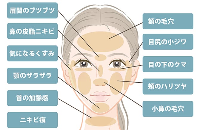 ダーマペン4 年齢肌改善 美容整形外科のジョウクリニック ダーマペン4 年齢肌改善 美容整形外科のジョウクリニック