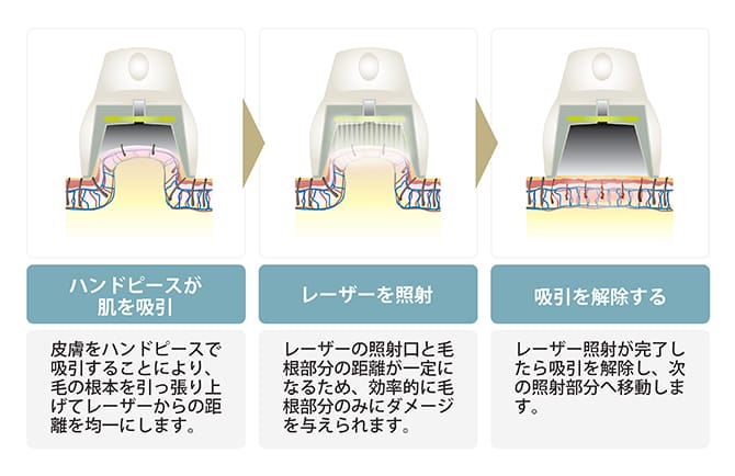 吸引システムイメージ図