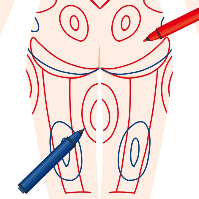 身体の脂肪吸引部分のデザイン