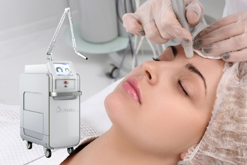 ピコレーザー・QスイッチYAGレーザー