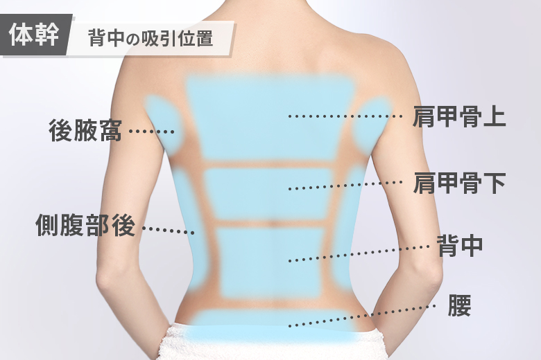 背中の脂肪吸引