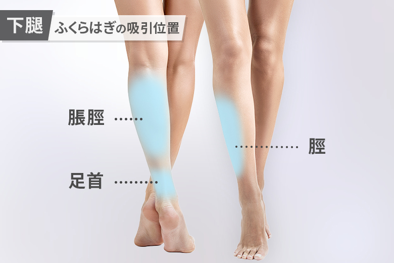 ふくらはぎの脂肪吸引