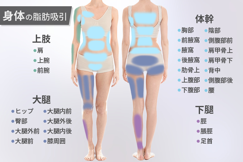 身体の脂肪吸引