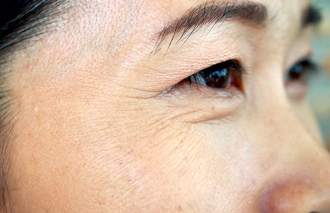 トータルアンチエイジングコース