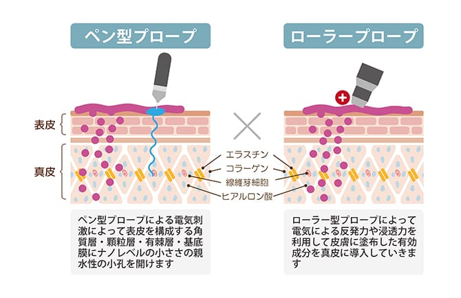 メソナJ（エイジングケア） | 美容整形外科のジョウクリニック