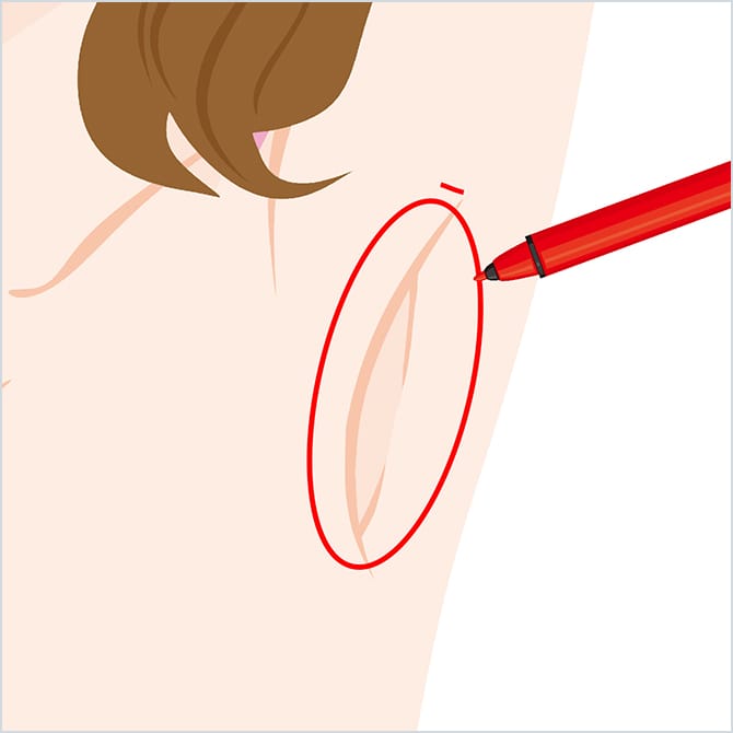 汗腺除去部分のデザインイメージ