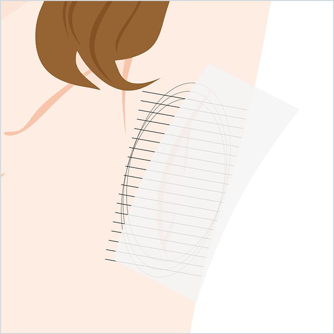 照射部位のデザイン