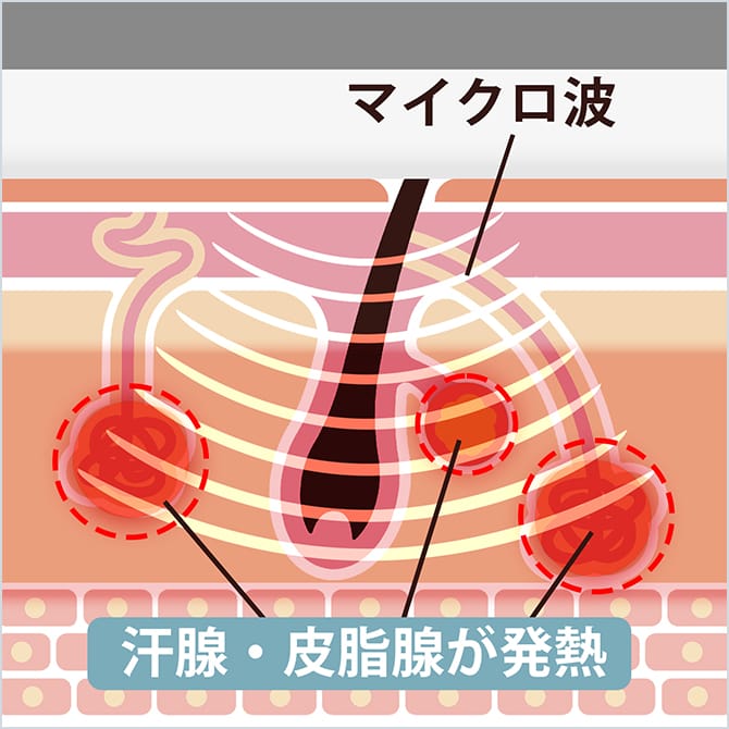 マイクロ波により汗腺・皮脂腺が発熱する