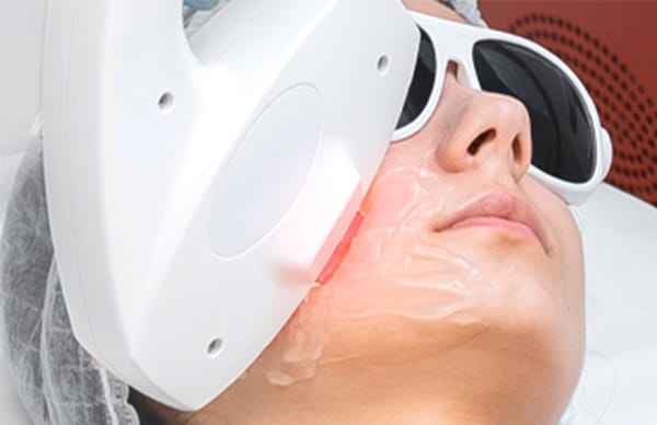ラメンテAurora Luminous 光脱毛フォトフェイシャルオーロラルミナス EvenSkyn® Lumo⁺: Best At-Home Anti-Aging & Skin Tightening
