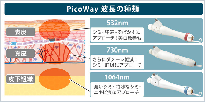 picoWayの3種の波長のレーザー
