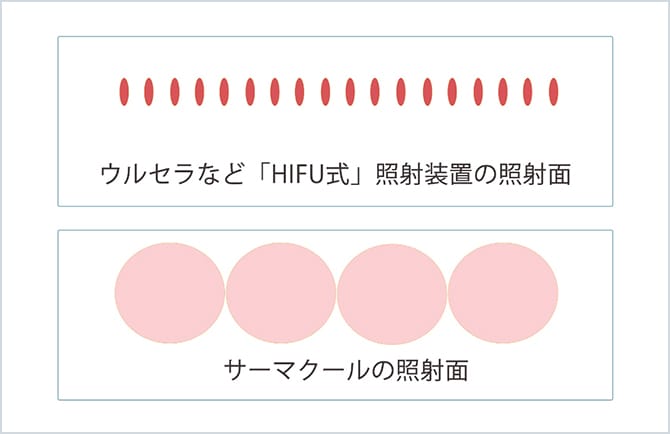 サーマクールの照射面イメージ図