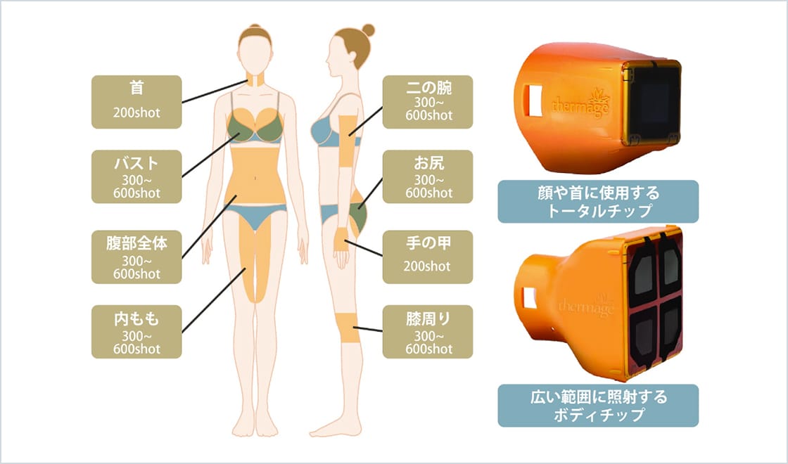 二の腕（300～600ショット）、首（200ショット）、バストアップ（300～600ショット）、腹部全体（300～600ショット）、お尻（300～600ショット）、太もも内側（300～600ショット）、手の甲（200ショット）、膝周り（300～600ショット）