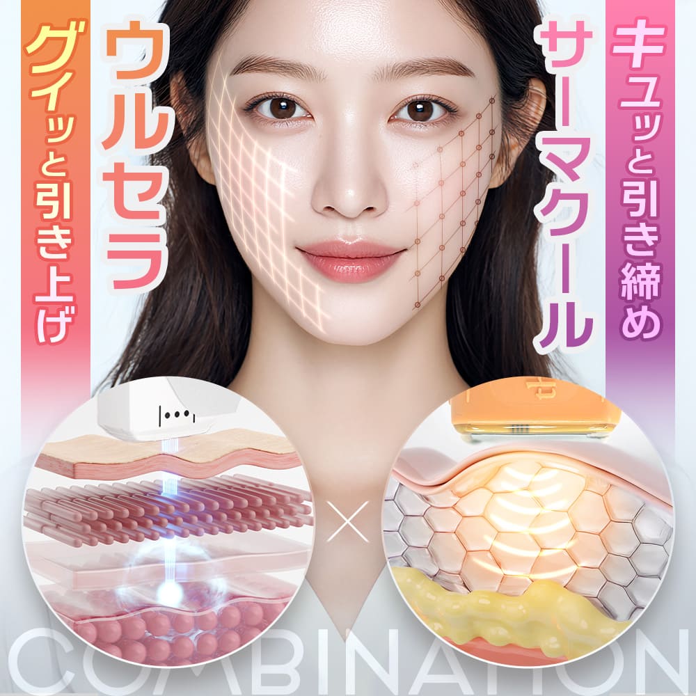 ウルセラ×サーマクール「ウルセラサーマ」