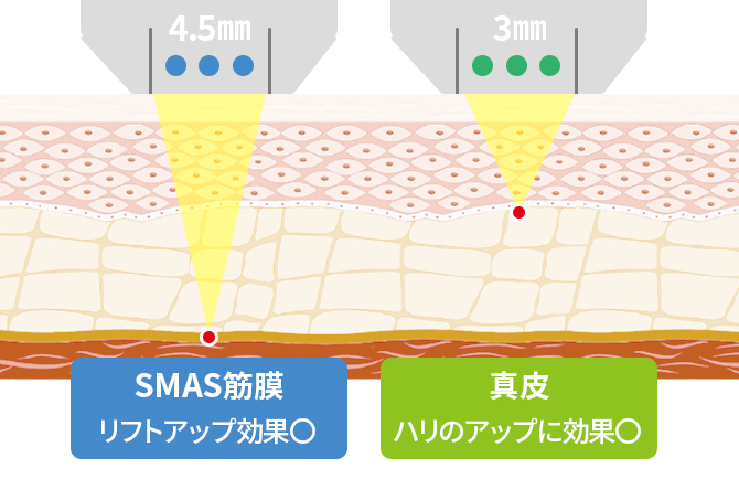 アプローチできる皮膚の深度