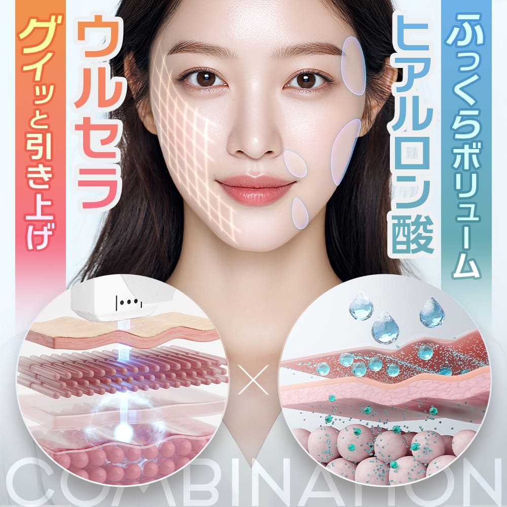 ウルセラ×糸リフト「ウルスレッド」