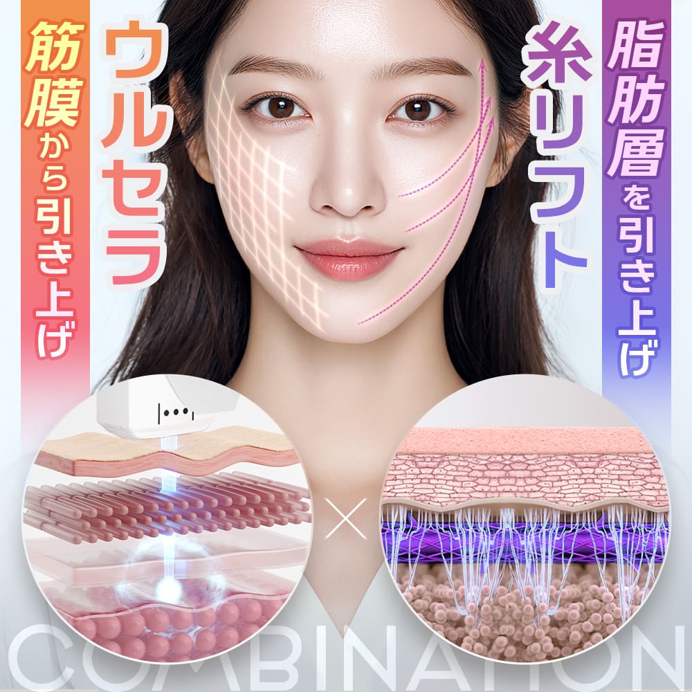 ウルセラ×糸リフト「ウルスレッド」