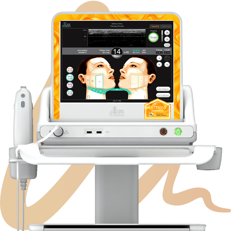 従来のウルセラ