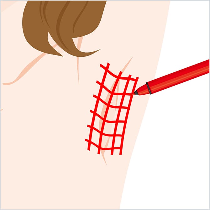 照射部位のデザイン