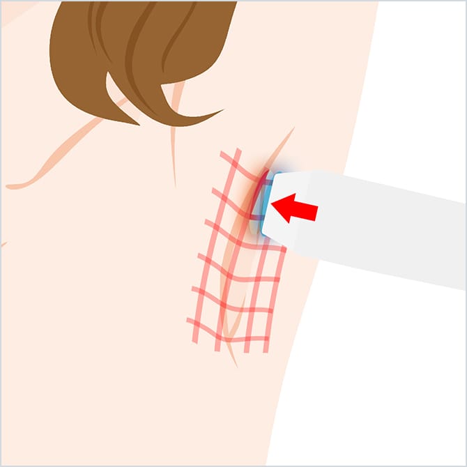 ビューホットでの施術