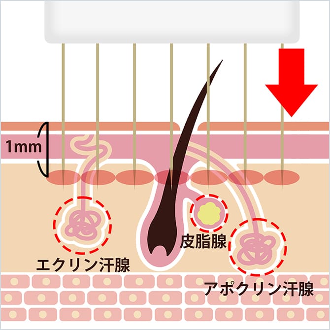 ビューホットでの施術