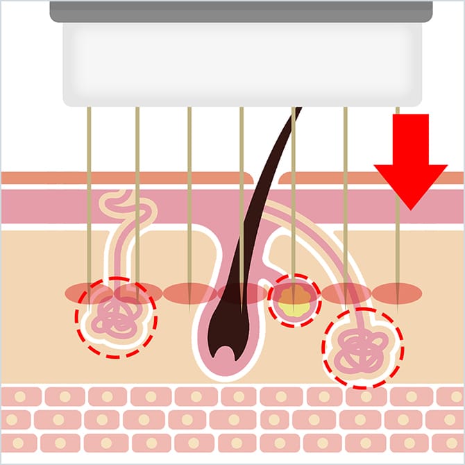 ビューホットでの施術