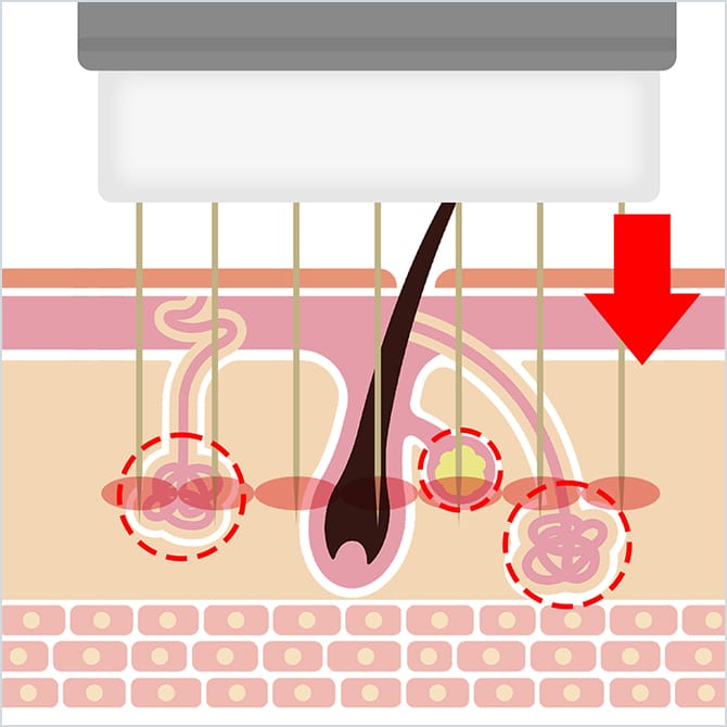 ビューホットでの施術