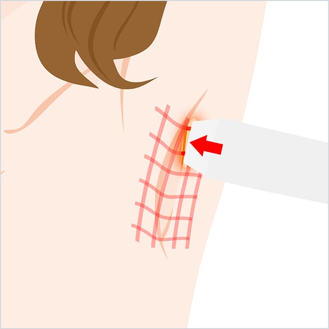 ビューホットでの施術