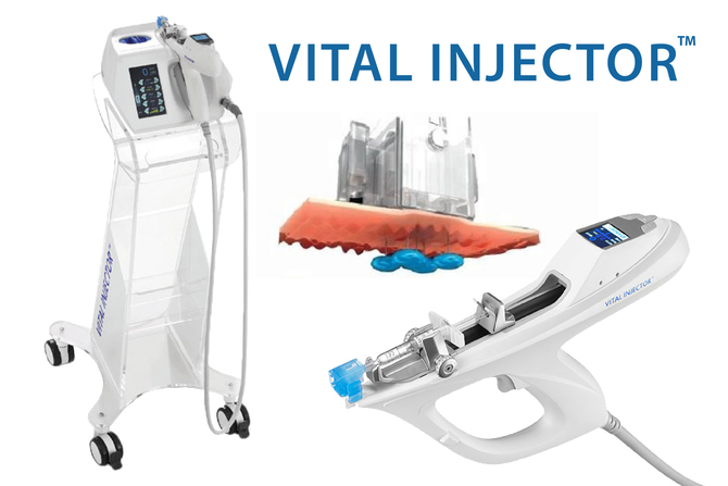 均一で正確なムラのない注入 Vital Injector
