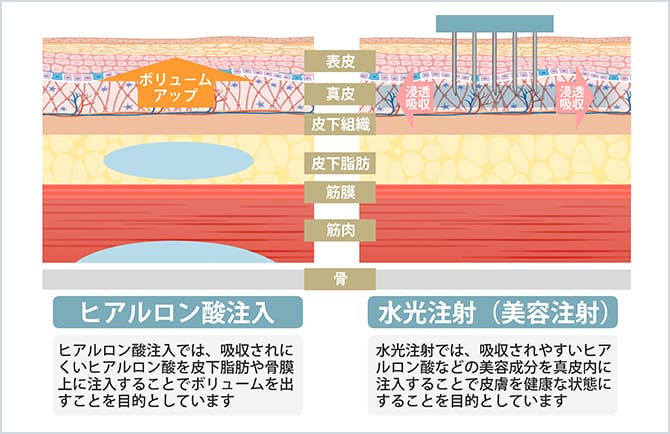 お肌に吸収されやすい美容成分を注入