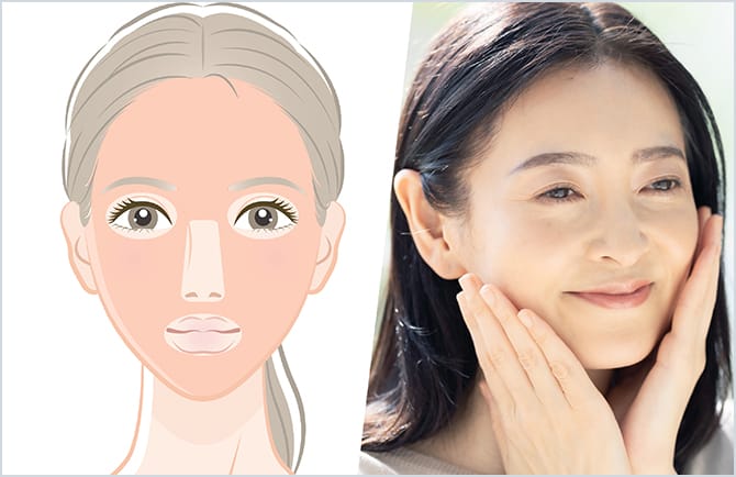 ACRS水光注射のイメージ