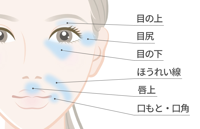 皮膚の薄い部分への注入