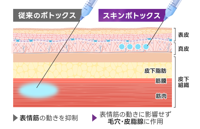 毛穴を収縮させて皮脂抑制・タイトニング