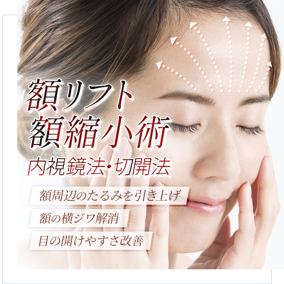 額リフト・額縮小術