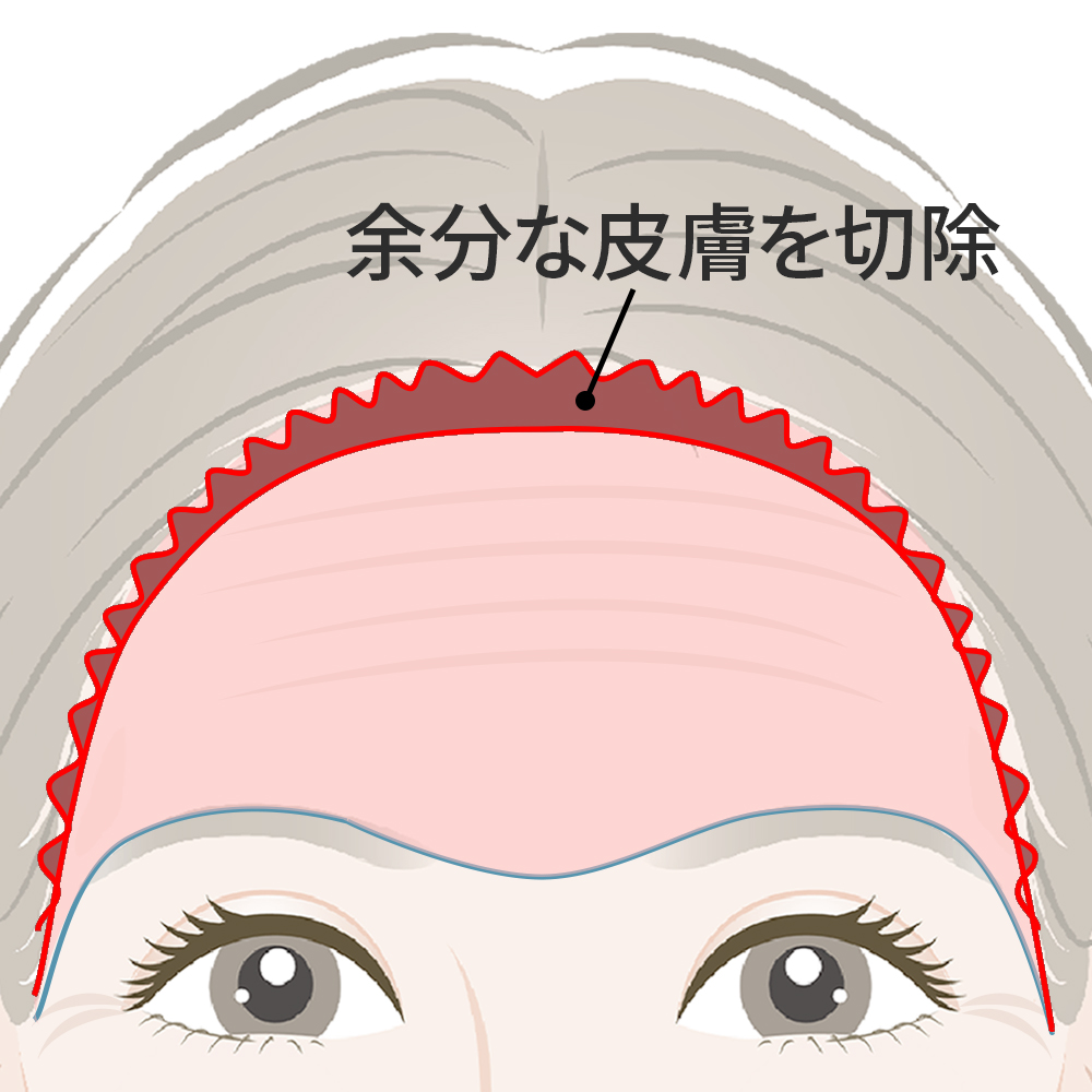 眉の位置や額のシワの状態を確認