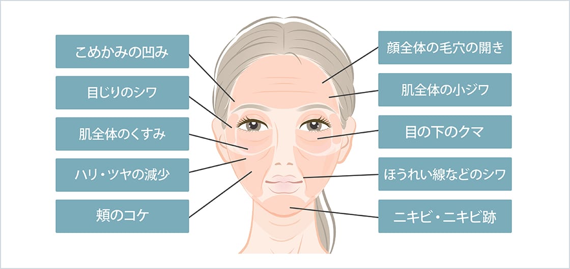 目尻のシワ、頬のたるみ、ほうれい線、ニキビ・ニキビ跡、お肌全体のくすみ、毛穴の開き、マリオネットライン、首のたるみやシワ