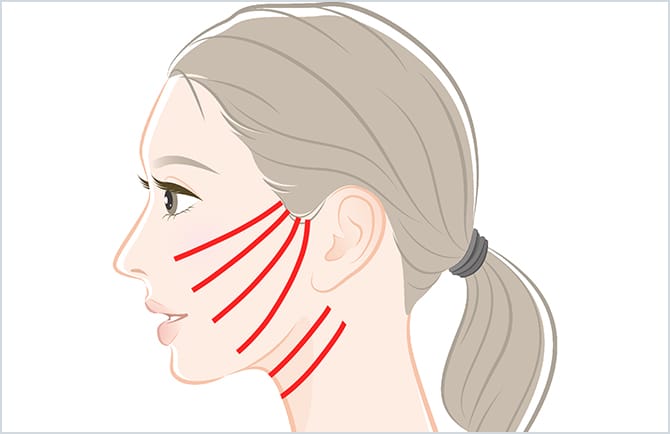 アンカーリフト使用