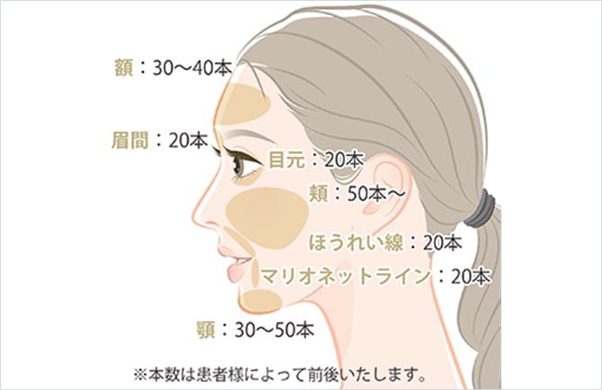ショッピングリフトの本数