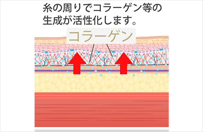 ショッピングリフトとコラーゲン