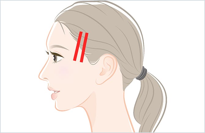 ハイリフトの使用