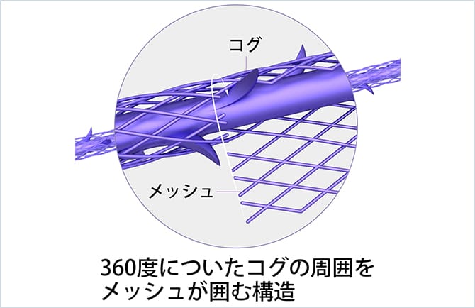 360度についたコグの周囲をメッシュが囲む構造