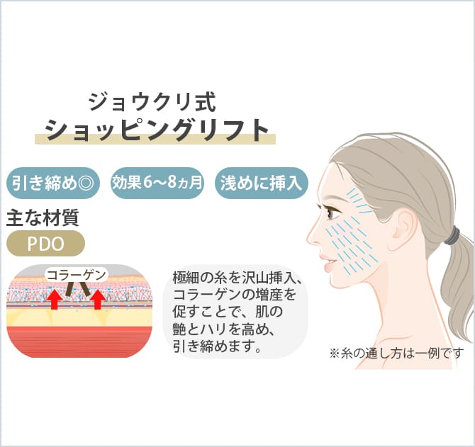 ショッピングスレッドの図