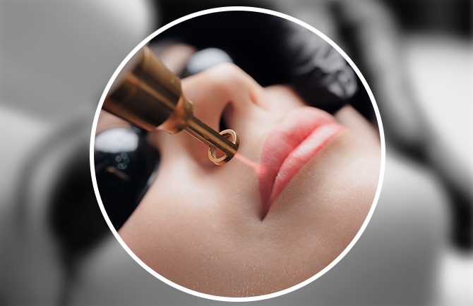 低侵襲レーザー除去 韓国式アートメイク除去