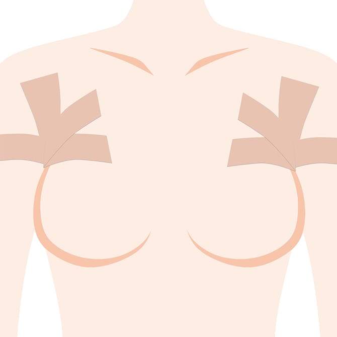 ワキをテープで固定したイラスト