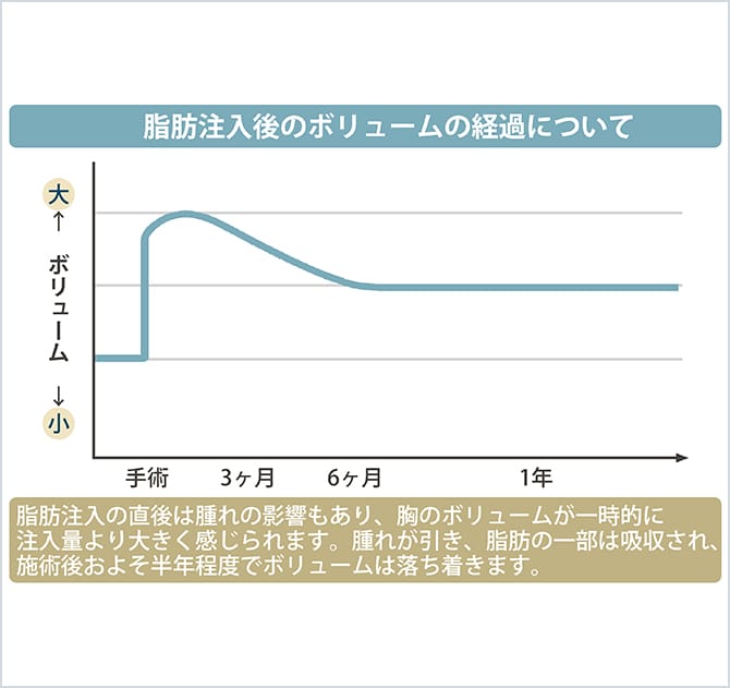 脂肪注入後のボリュームの経過について