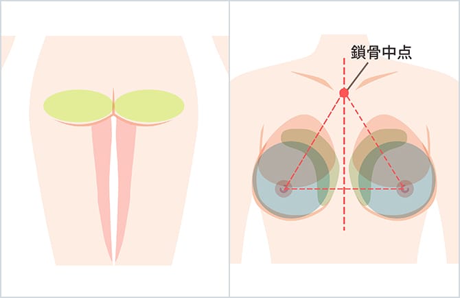 採脂部分・豊胸部分のデザイン
